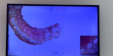 Diş Hekimliğinde Dijital Dönüşüm: Konforlu ve Hızlı Tedavi Dönemi Başladı